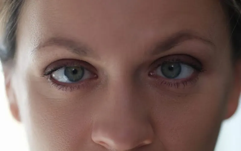 Amblyopia — lazy eye